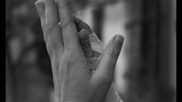 Manual de epidermólisis Bullosa