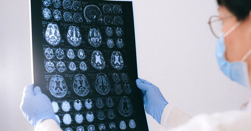 Un ciéntifico observa una radiografía